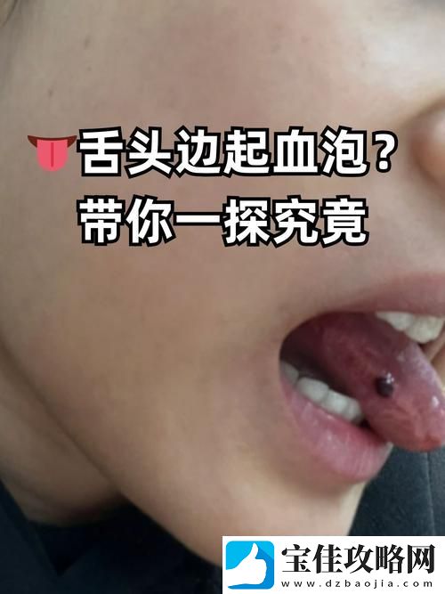 他的舌头探进蜜源毛毛虫说说-友：太有创意了！