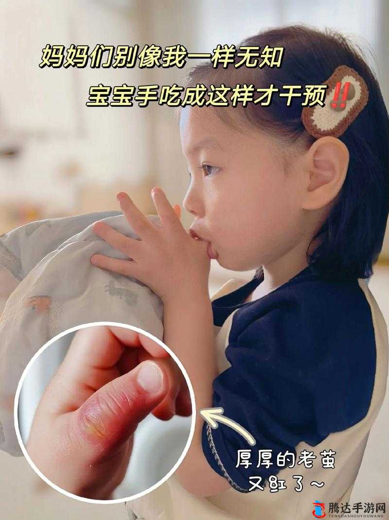 宝宝才三根手指就受不了：揭示宝宝的敏感与脆弱
