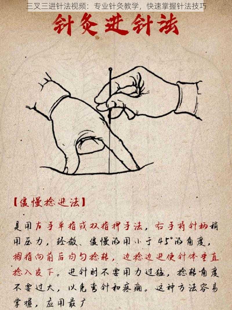 三叉三进针法视频：专业针灸教学，快速掌握针法技巧
